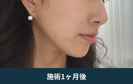 after_Img