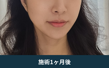 after_Img