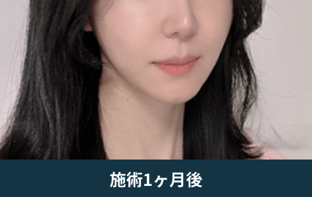 after_Img